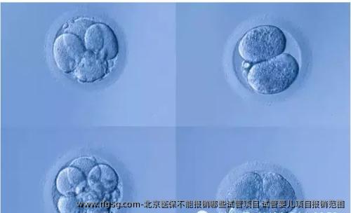 北京医保不能报销哪些试管项目 试管婴儿项目报销范围