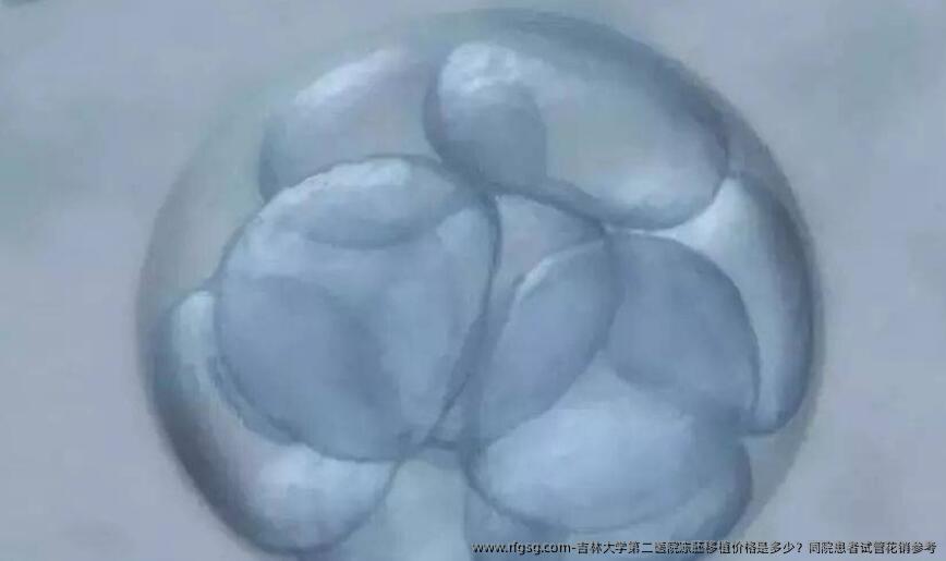 吉林大学第二医院冻胚移植价格是多少？同院患者试管花销参考