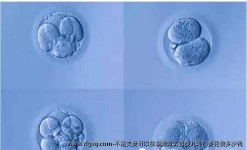 不是夫妻可以在泰国做试管婴儿吗？要花费多少钱