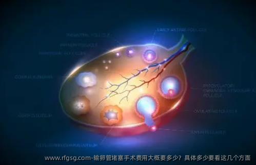 输卵管堵塞手术费用大概要多少？具体多少要看这几个方面