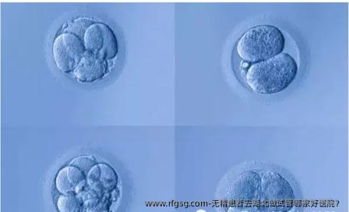 无精患者去湖北做试管哪家好医院？