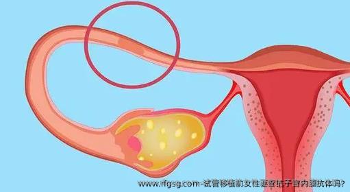 试管移植前女性要查抗子宫内膜抗体吗?