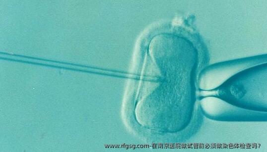 在南京医院做试管前必须做染色体检查吗？