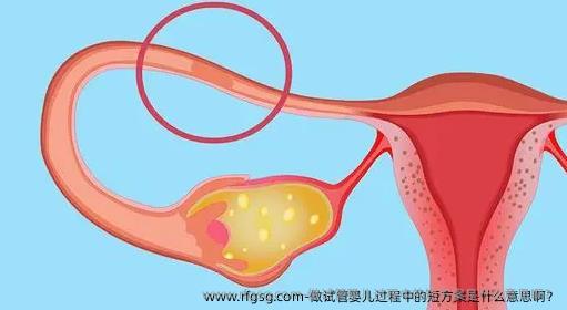 做试管婴儿过程中的短方案是什么意思啊？