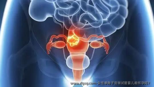 女性单角子宫做试管婴儿能怀孕吗？