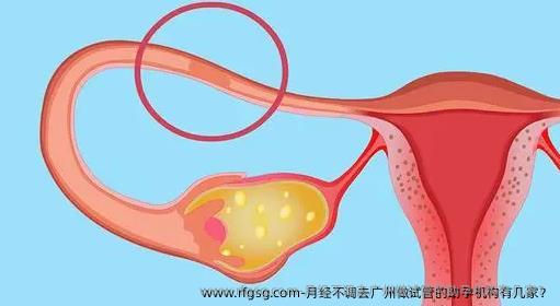 月经不调去广州做试管的助孕机构有几家？