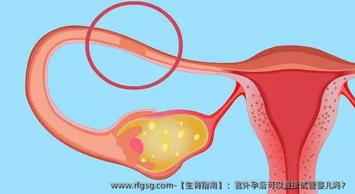 【生育指南】：宫外孕后可以直接试管婴儿吗？