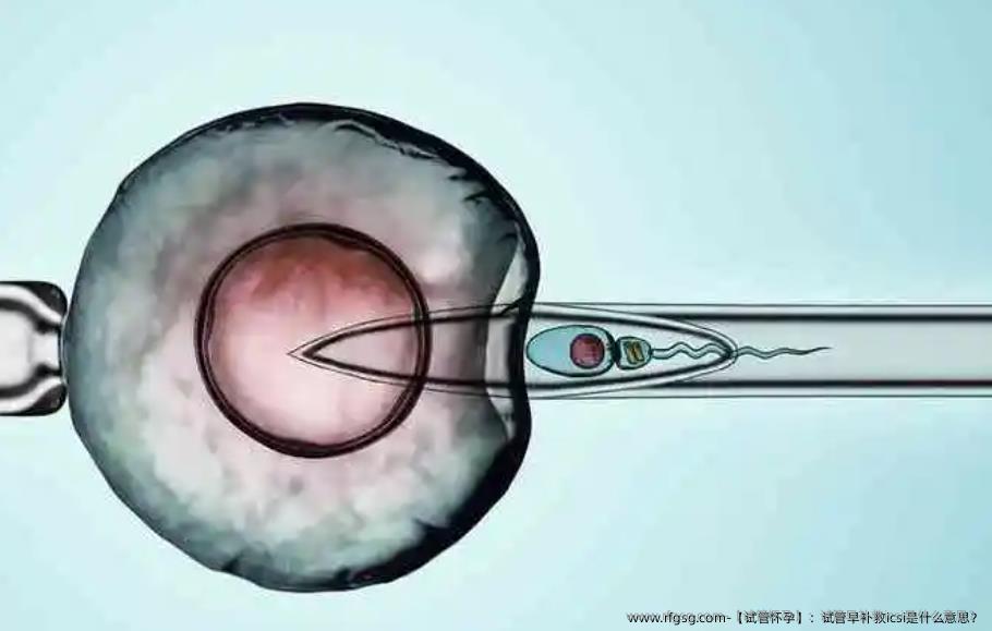 【试管怀孕】：试管早补救icsi是什么意思？