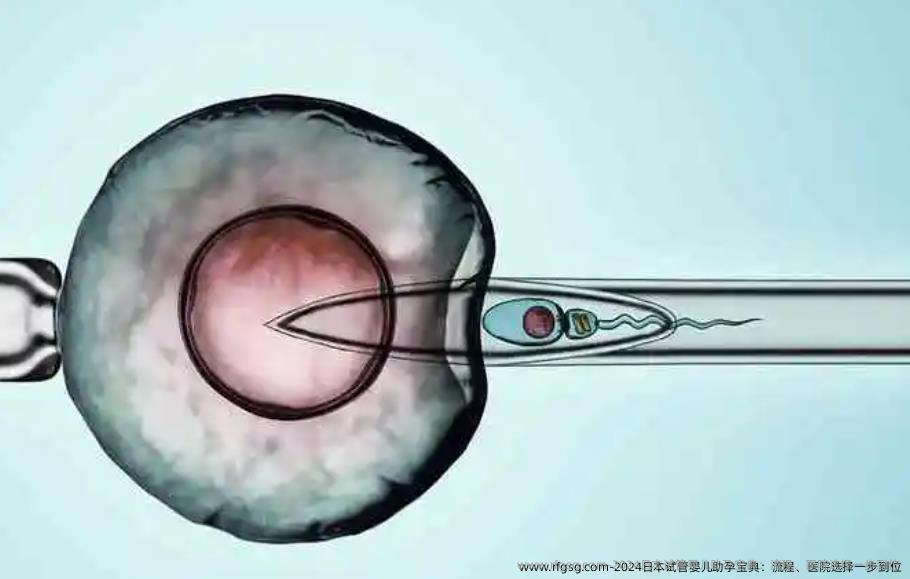 2024日本试管婴儿助孕宝典：流程、医院选择一步到位