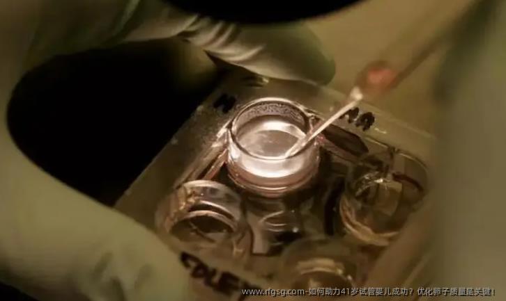 如何助力41岁试管婴儿成功？优化卵子质量是关键！