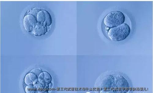 第三代试管技术有什么优势？第三代试管孕育零缺陷婴儿！