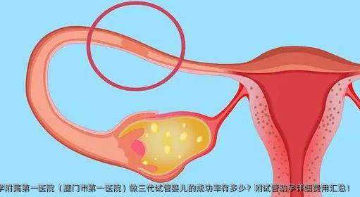 厦门大学附属第一医院（厦门市第一医院）做三代试管婴儿的成功率有多少？附试管助孕详细费用汇总！