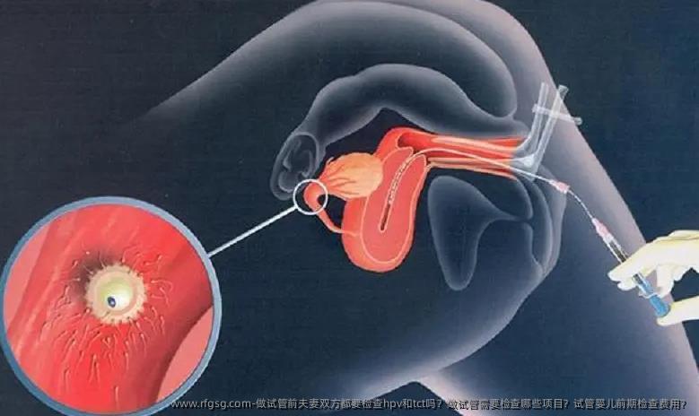 做试管前夫妻双方都要检查hpv和tct吗？做试管需要检查哪些项目？试管婴儿前期检查费用？