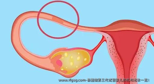 泰国做第三代试管婴儿的机构名单一览！