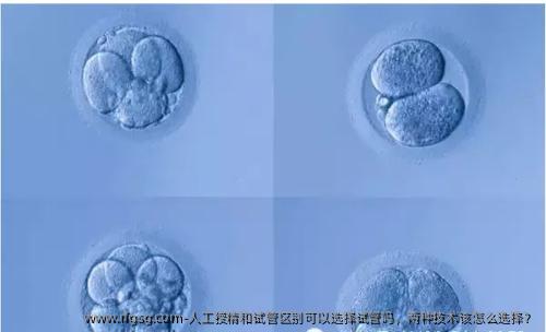 人工授精和试管区别可以选择试管吗，两种技术该怎么选择？