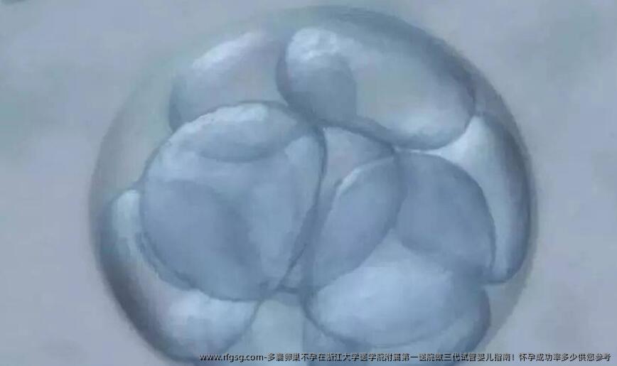 多囊卵巢不孕在浙江大学医学院附属第一医院做三代试管婴儿指南！怀孕成功率多少供您参考