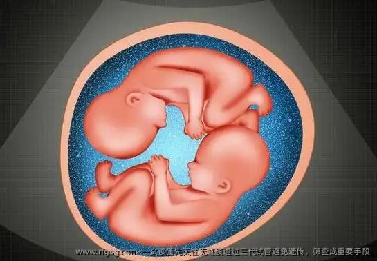 一文读懂先天性无虹膜通过三代试管避免遗传，筛查成重要手段