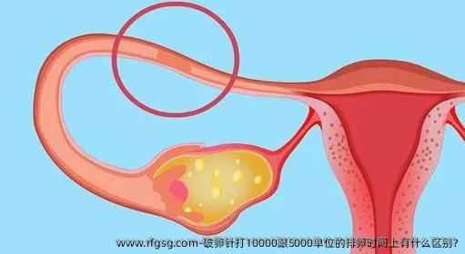 破卵针打10000跟5000单位的排卵时间上有什么区别?