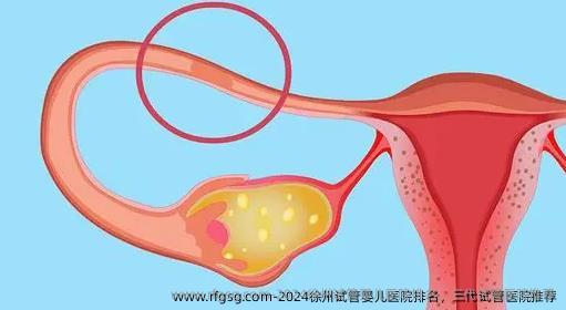 2024徐州试管婴儿医院排名，三代试管医院推荐