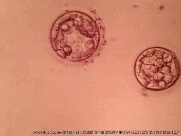 弱精症不育可以去福清市做试管助孕生孩子吗?三代试管婴儿的前提是什么?