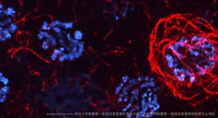 苏州大学附属第一医院试管需要花费多少钱？苏州大学附属第一医院试管费用明细是怎么样的