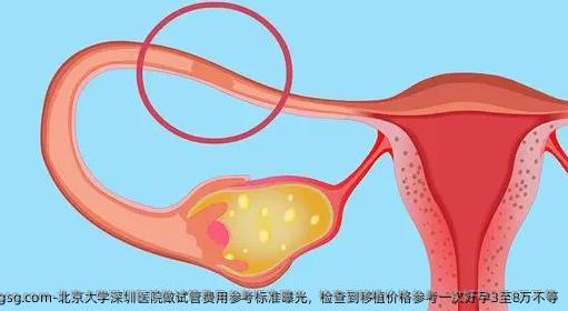 北京大学深圳医院做试管费用参考标准曝光，检查到移植价格参考一次好孕3至8万不等