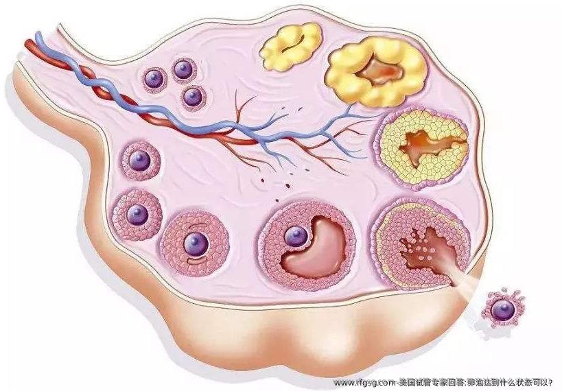 美国试管专家回答:卵泡达到什么状态可以？