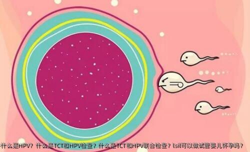 什么是HPV？什么是TCT和HPV检查？什么是TCT和HPV联合检查？lsil可以做试管婴儿怀孕吗？