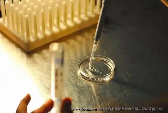 女性患有多囊卵巢综合征可以做试管婴儿吗？