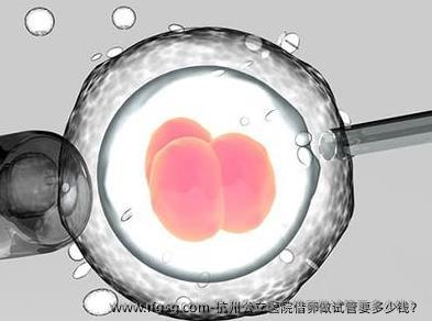 杭州公立医院特需做试管要多少钱？