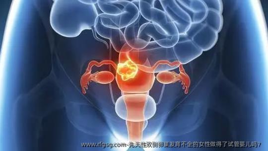 先天性双侧卵巢发育不全的女性做得了试管婴儿吗？