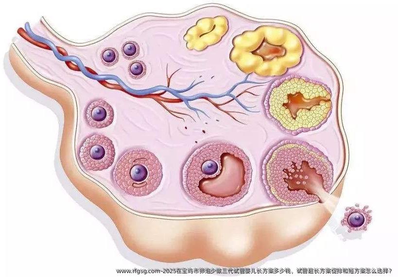 2025在宝鸡市卵泡少做三代试管婴儿长方案多少钱，试管超长方案促排和短方案怎么选择？