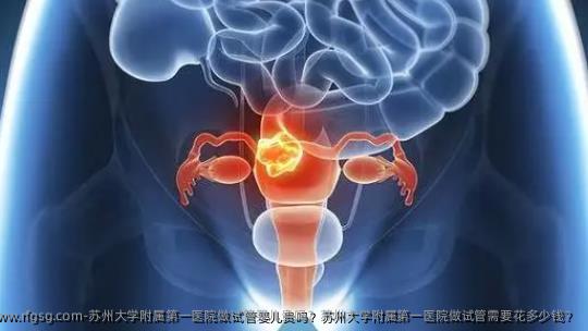 苏州大学附属第一医院做试管婴儿贵吗？苏州大学附属第一医院做试管需要花多少钱？