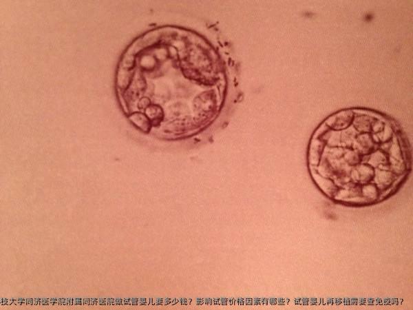 华中科技大学同济医学院附属同济医院做试管婴儿要多少钱？影响试管价格因素有哪些？试管婴儿再移植需要查免