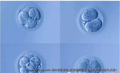 海外试管资讯-新加坡的试管婴儿技术可以做几次呢？