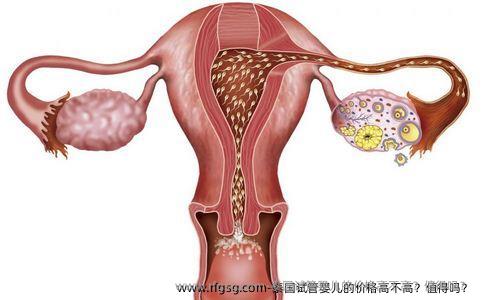 泰国试管婴儿的价格高不高？值得吗？