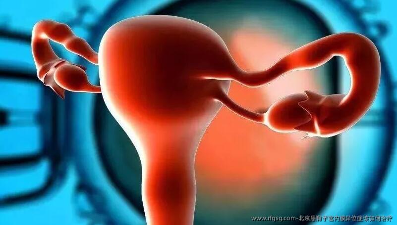 北京患有子宫内膜异位症该如何治疗